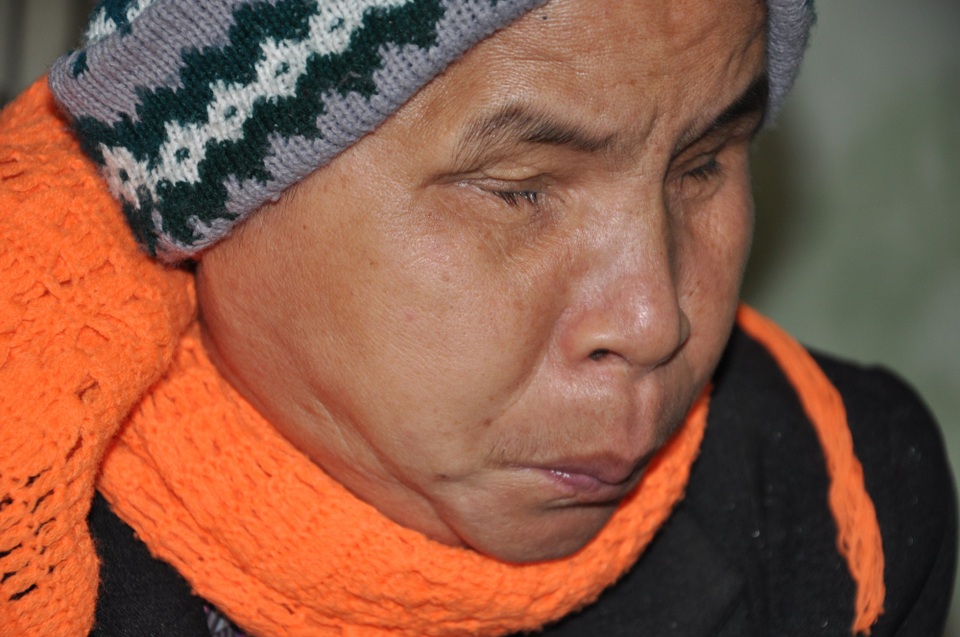 Cơ cực người đàn bà chăm chồng ung thư, em chồng bị mù lòa - 1 Cô Bòng (em gái chồng cô Minh) đã bị mù hơn 40 năm qua.