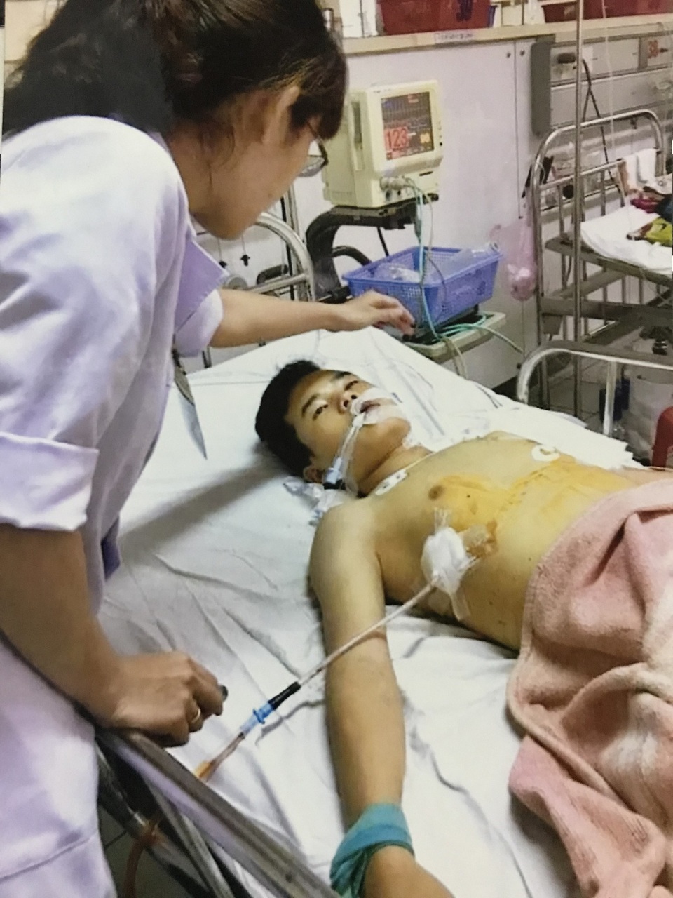 Chồng ngược đãi, vợ một mình gồng gánh chữa bệnh cho 3 con bệnh tật, tai nạn - 4 Người con thứ 3 của chị bị tai nạn bất ngờ và nặng khi đi chở khách thuê từ Đà Nẵng ra Huế