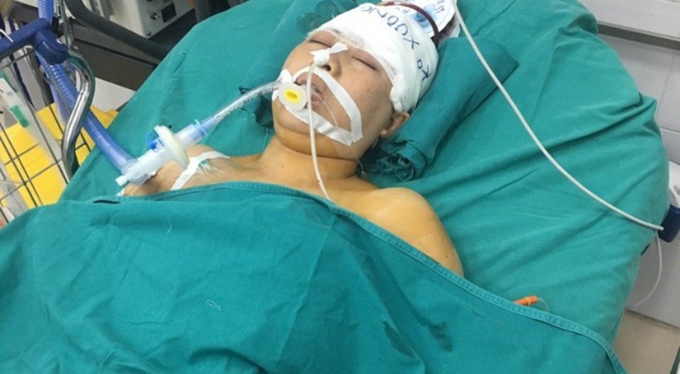 Vợ nguy kịch khi đi mua cháo chăm chồng chấn thương sọ não - 2 Chị Thành đang nằm điều trị tại Bệnh viện Việt Đức