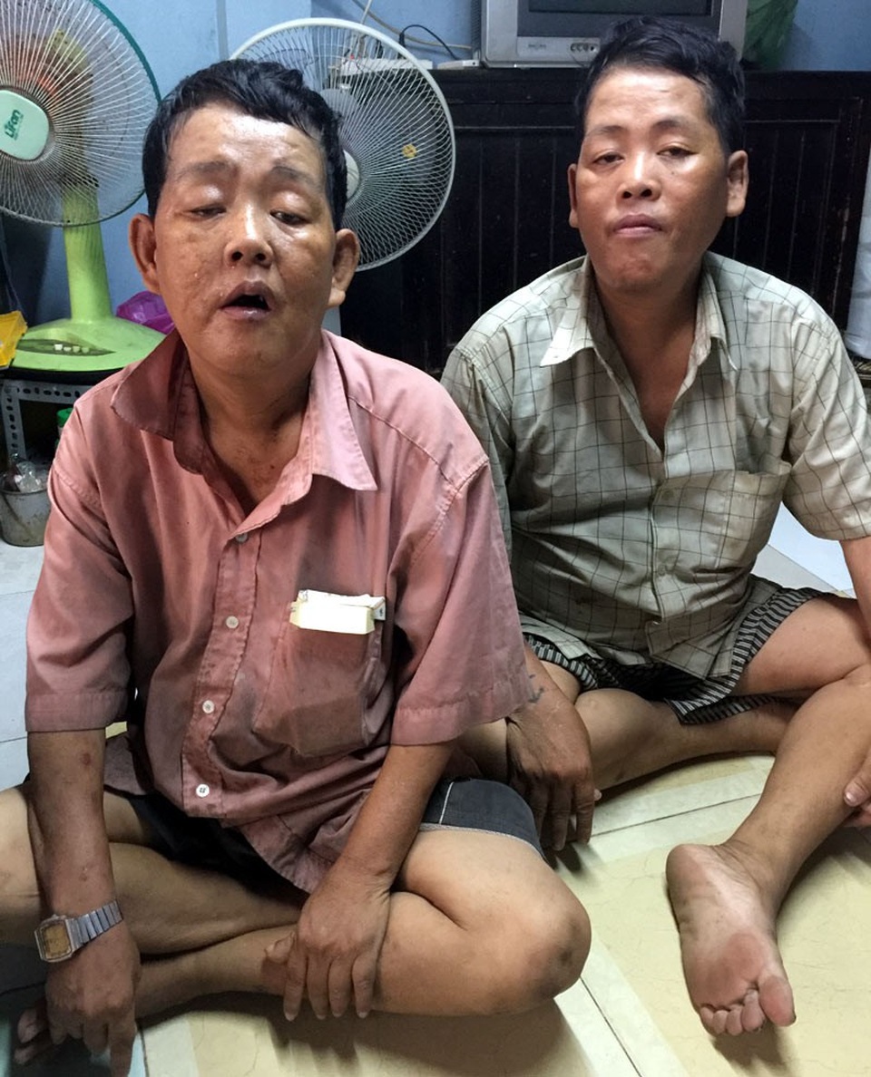 Bữa cơm 15.000 đồng của gia đình 5 người ở Sài Gòn - 4 Hai anh em bị bệnh tâm thần.