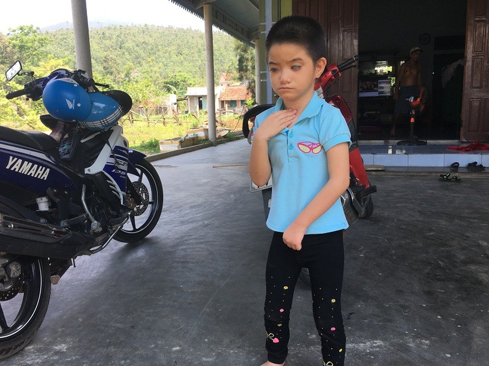 Niềm vui khó tả của cô bé bị tim, hỏng hai mắt - 3 Niềm vui khó tả của cô bé bị tim, hỏng hai mắt - 3