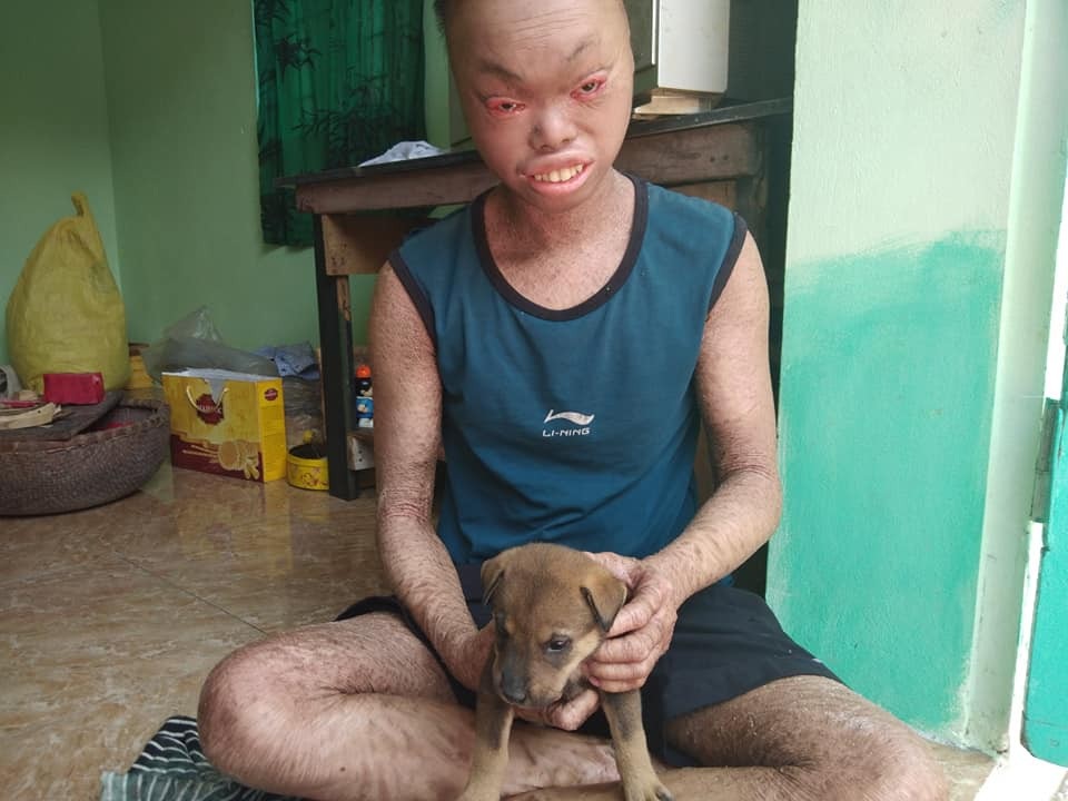 Mẹ rao bán chó mong có tiền nộp học phí cho con - 6
Do chịu khó tắm lá nên da em có đỡ hơn, nhưng cơ thể vẫn xù xì, khó coi. Cả ngày em chỉ ở nhà chứ chẳng dám đi đâu vì ai nhìn thấy cũng sợ