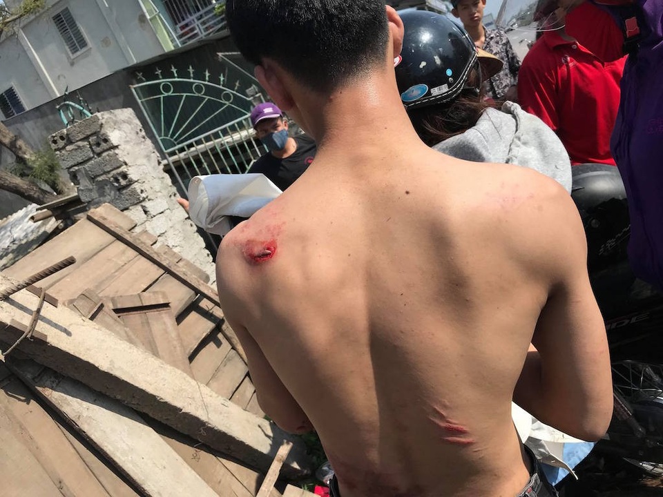 
Một trong hai nam thanh niên đi trên xe máy bị thương nhẹ được người dân sơ cứu.
