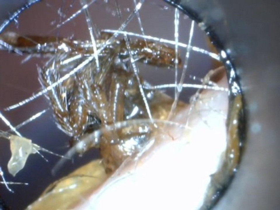 Trong video quay cận cảnh, con nhện trông cực kỳ rõ nét