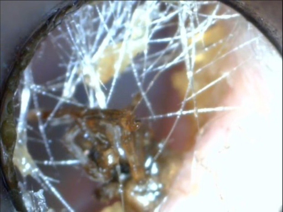 Nhiều người cảm thấy ghê sợ khi xem video này