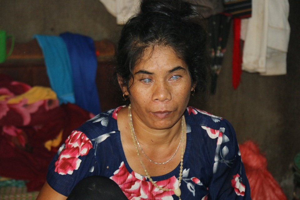 Bị phụ bạc, con lại mắc bệnh hiểm nghèo, chị H Jiêng bị hỏng cả hai đôi mắt sau đợt ốm nặng