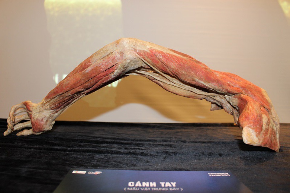 Mẫu vật cánh tay người thật đã được xử lý bằng công nghệ ướp xác