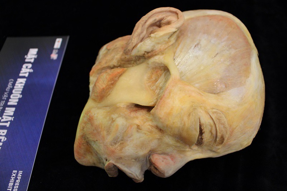 Những tác động tốt hoặc xấu từ môi trường, sinh hoạt sẽ thể hiện qua các mẫu trưng bày