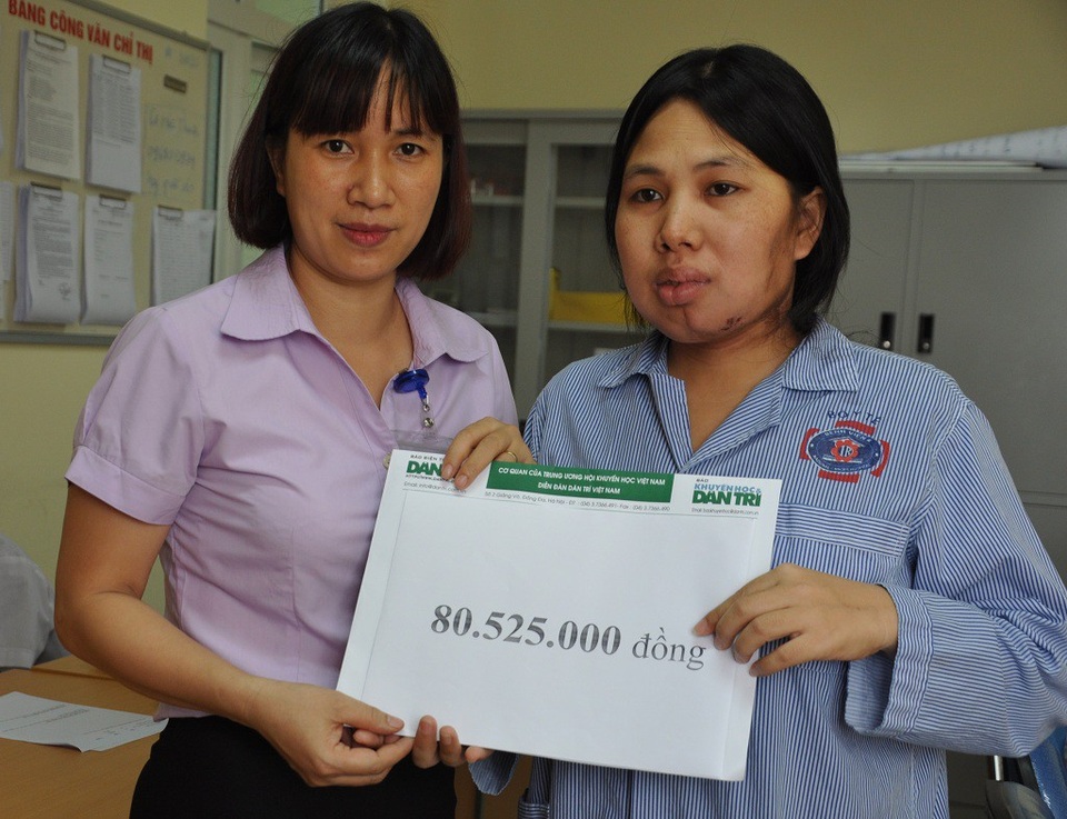 Hơn 80 triệu đồng đến với vợ chồng chị Vân bị ung thư - 3 Cán bộ phòng CTXH bệnh viện thay mặt trao quà của bạn đọc báo điện tử Dân trí đến tay chị Vân.