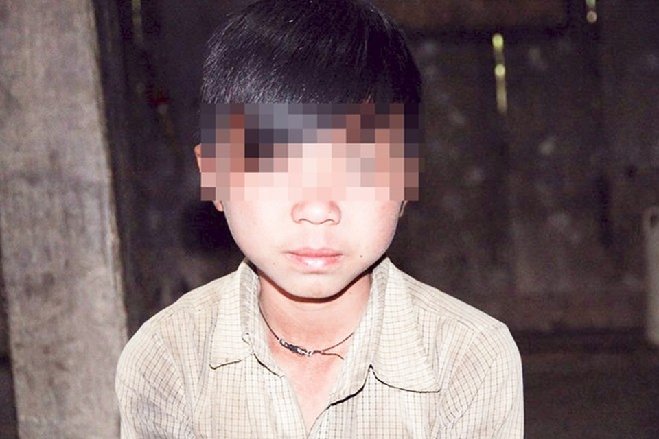 Một cậu bé có hai bộ phận sinh dục ở Yên Cường.