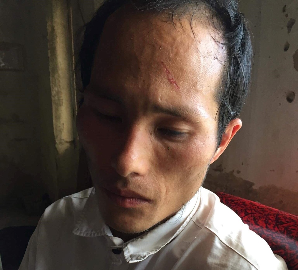 Bắt 2 đối tượng, thu giữ 2 bánh heroin - 2 Đối tượng Lỳ Bá So.