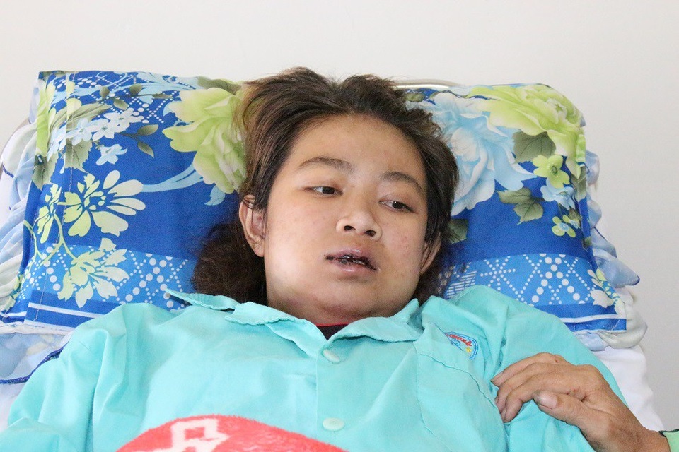 Thanh hoa có thể ra đi bất kỳ lúc nào nếu bỏ ngang điều trị