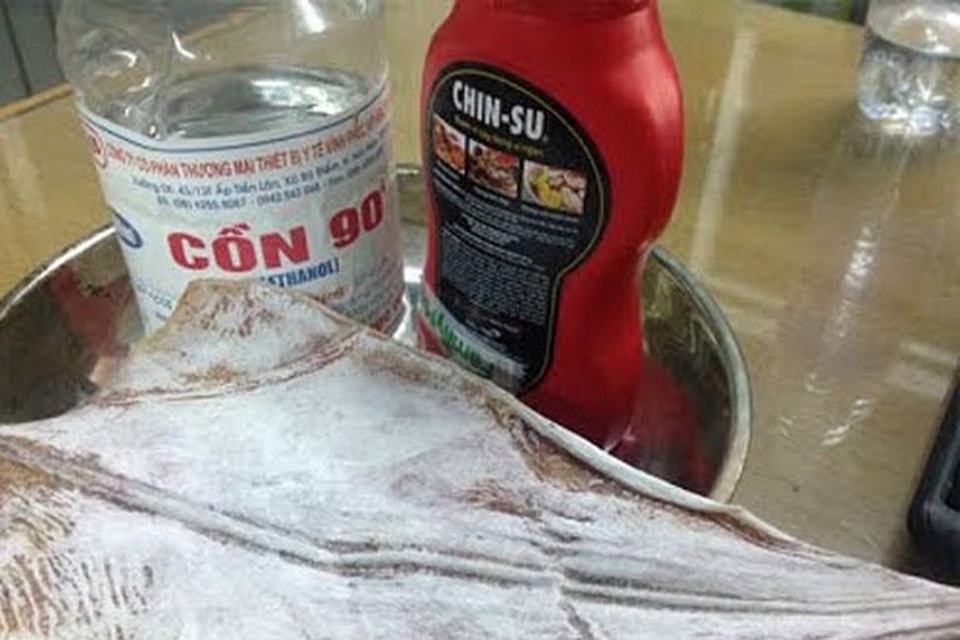 Bỏng nặng do nướng cá mực bằng cồn - 1 Ảnh minh họa