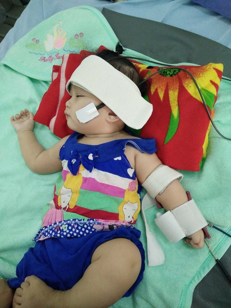 Vụ bé gái vừa chào đời bị liệt cánh tay: Bộ Y tế chỉ đạo Sở Y tế Đồng Tháp báo cáo! - 2 Gia đình anh Quý vô cùng bức xúc khi đứa con của anh vừa chào đời đã bị liệt tay trái và dị tật ở mắt trái. Mặc dù trước đó các siêu ẩm, kết quả chẩn đoán thai nhi không bị dị tật nào