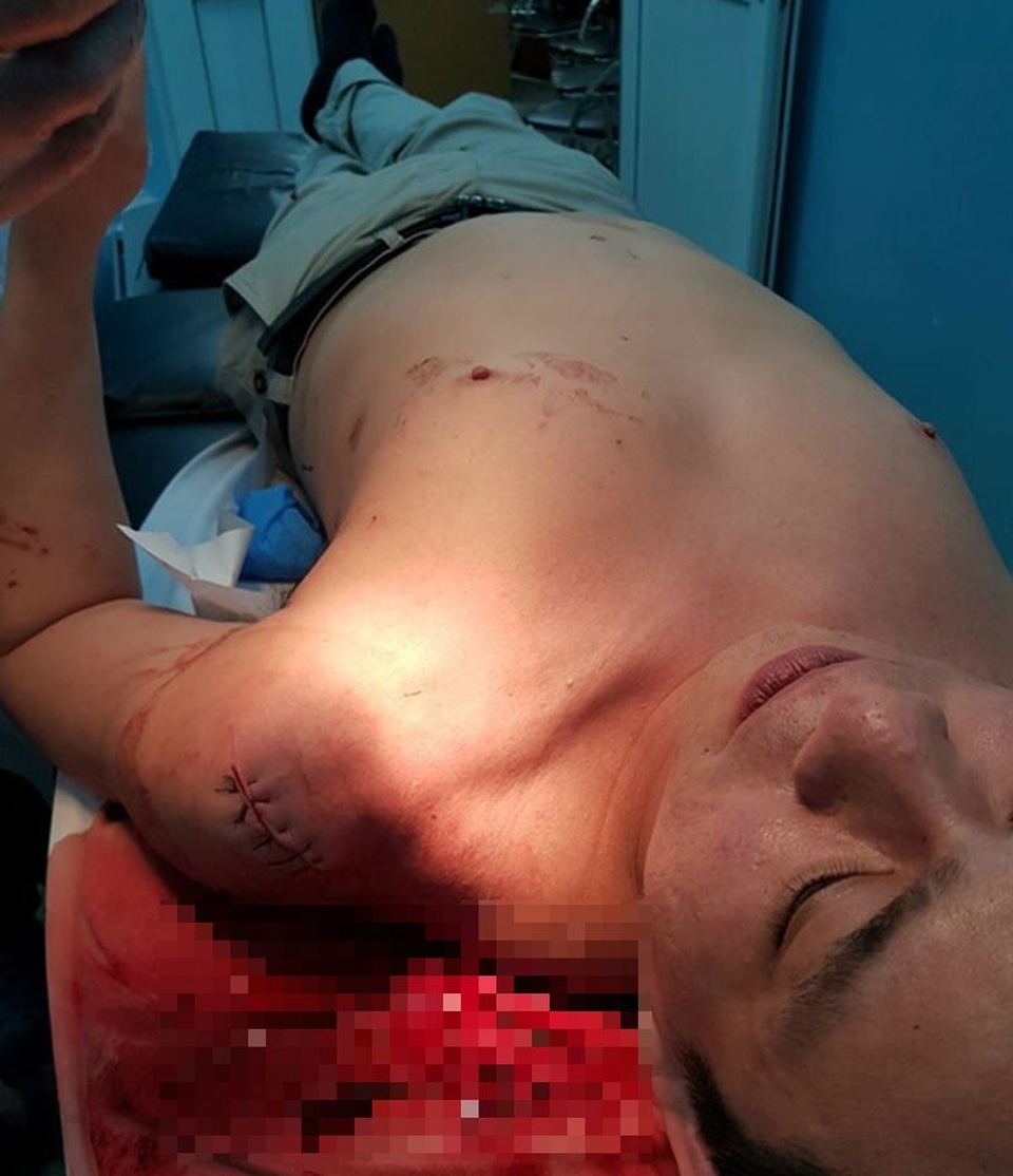 Vụ truy sát bác sĩ Chiêm Quốc Thái: Hé lộ vai trò của 1 nữ bác sĩ - 2
Bác sĩ Chiêm Quốc Thái cho rằng, ông may mắn thoát chết trong vụ truy sát ở phố đi bộ Nguyễn Huệ cách đây mấy tháng