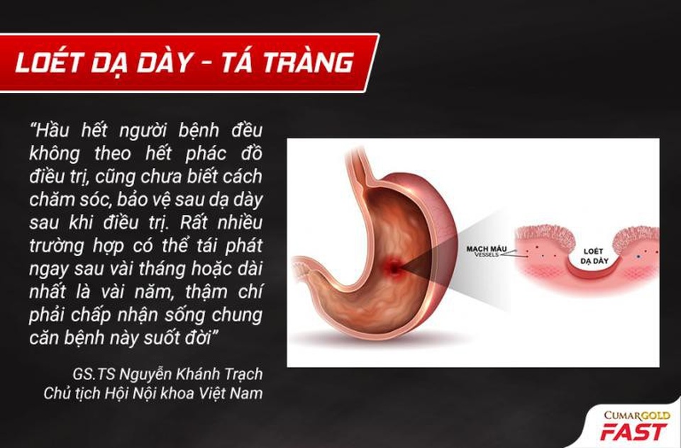 Sự thật ít ai biết để tránh tái phát viêm loét dạ dày - 1 Điều quan trọng nhất - cần làm lành vết loét, phục hồi được niêm mạc tổn thương