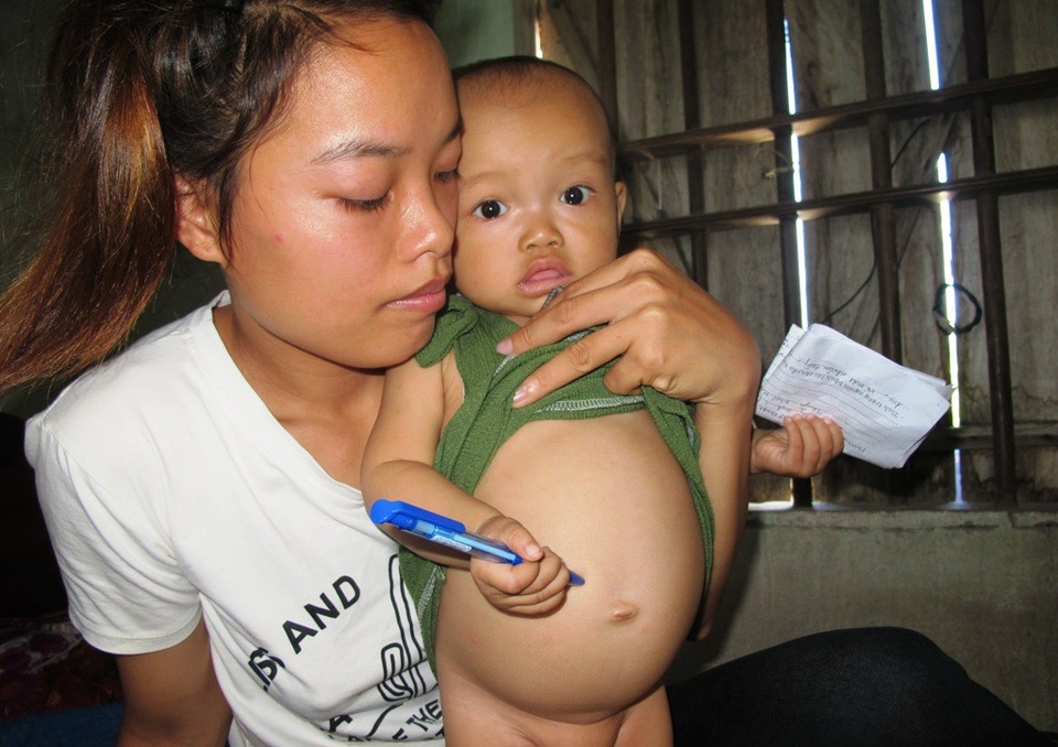 ... ngày đêm với cái bụng chướng, gan lách to trên cơ thể bé bỏng.