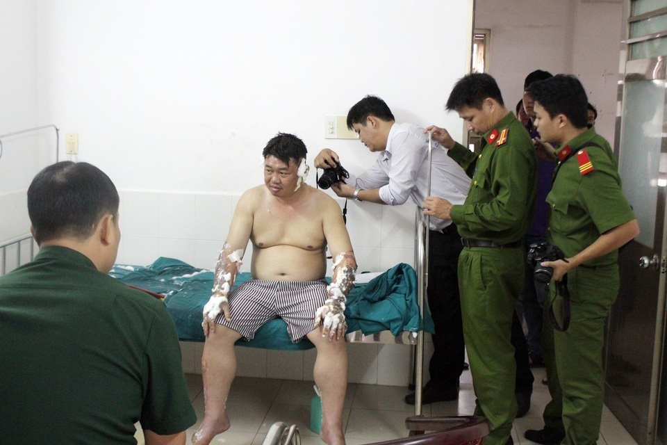 Tuyên 6 năm tù cho đối tượng dùng “bom xăng” tấn công người khác - 1 Anh Huy bị bỏng thương tích 32%