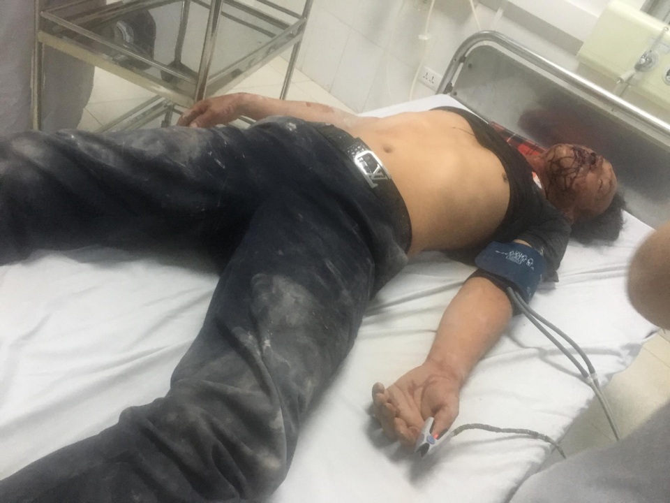 Vụ 3 người trong một nhà bị côn đồ đánh trọng thương: Khởi tố bị can 1 đối tượng - 2 Một trong 3 nạn nhân nhập viện trong tình trạng nguy kịch