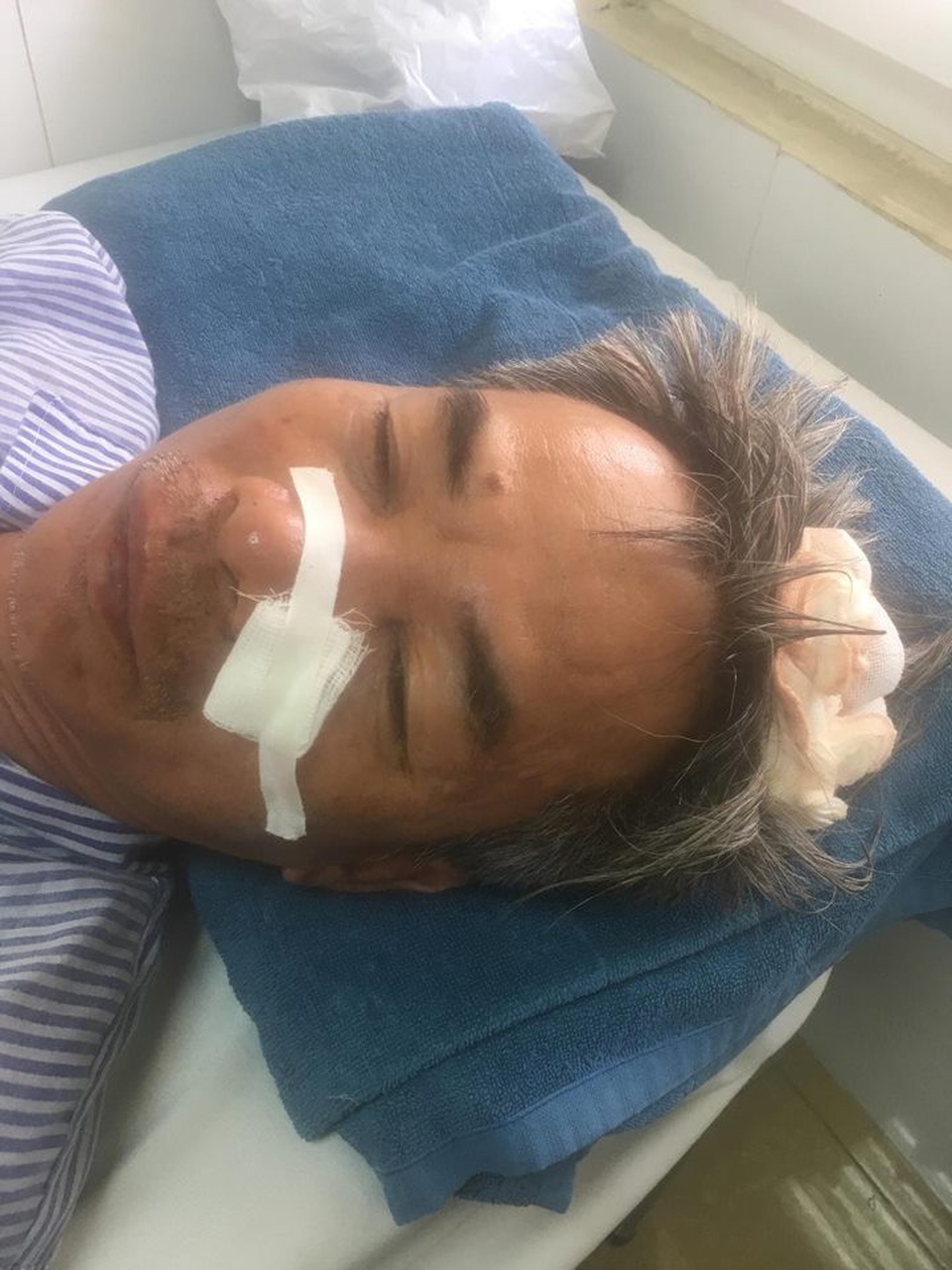 Bị côn đồ đánh đập dã man, 3 người trong một nhà trọng thương - 2 
Ông Minh bị khâu 10 mũi ở đầu do bị nhóm côn đồ dùng tuýp sắt vụt vào đầu