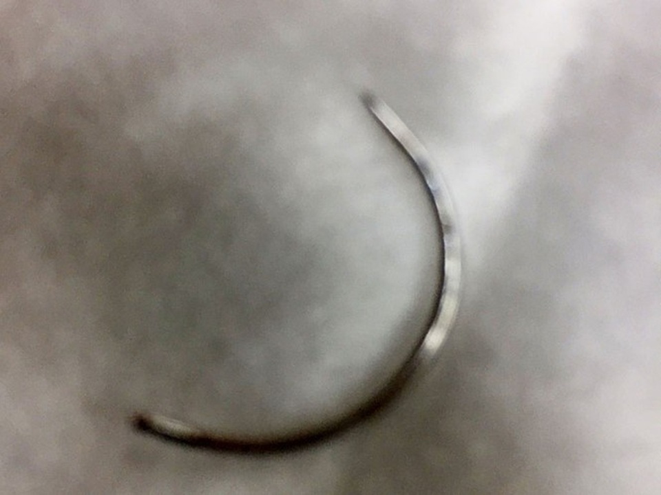 Kim khâu “thất lạc” trong tầng sinh môn của sản phụ - 1 Chiếc kim khâu thất lạc trong cơ thể người bệnh được bác sĩ phẫu thuật lấy ra ngoài (ảnh: gia đình cung cấp)