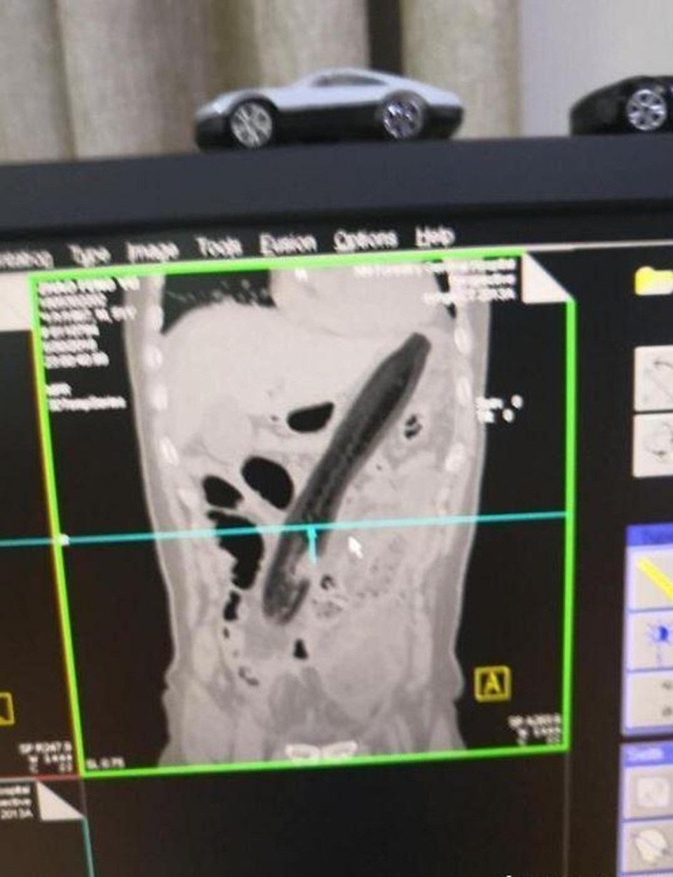 Chỉ vì trái cà dài 30 cm mà người đàn ông trung niên đã suýt nữa mất mạng