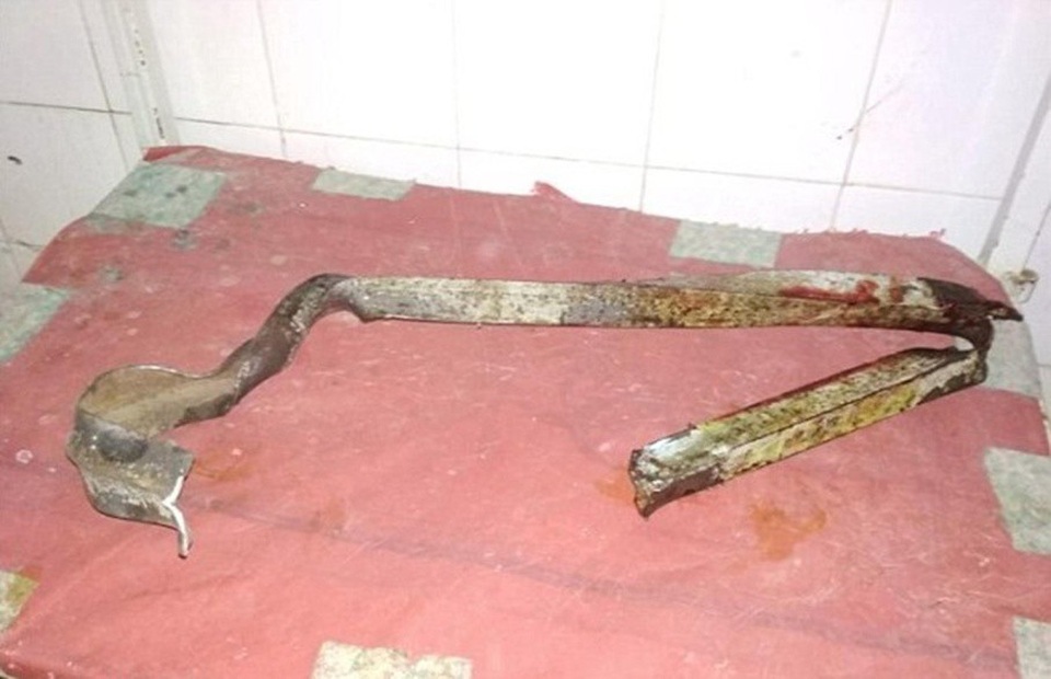 Sống sót thần kỳ sau khi bị thanh sắt dài 5 mét đâm xuyên người - 3 Cận cảnh thanh sắt đâm qua người chàng trai