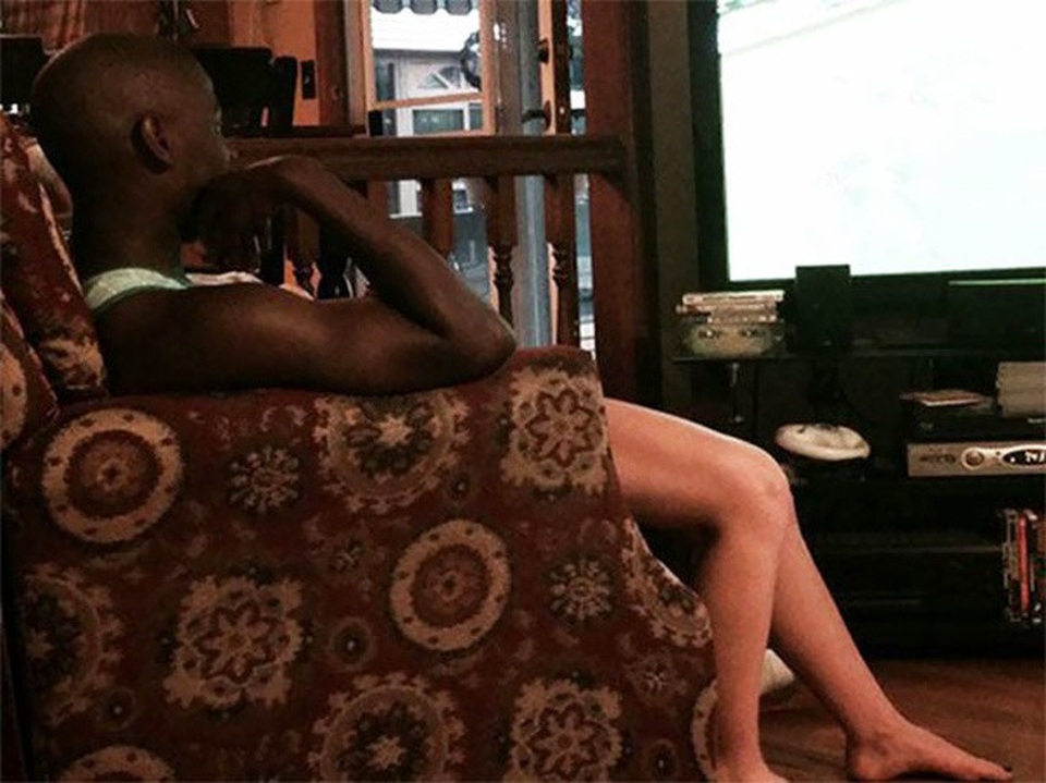 Chàng trai da đen nhưng lại có... đôi chân trắng