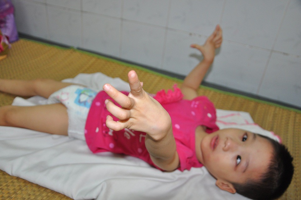 Nỗi đau đớn tột cùng của gia đình nghèo có con lớn chết đuối, hai con nhỏ bại não - 4 Em bị bại não khi mới sinh ra nên không tự làm gì được.