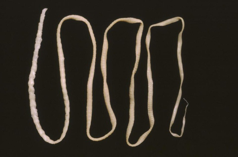 Chỉ thấy ngứa chân, ai ngờ do có sán trong cột sống - 4 Hình ảnh sán Echinococcus granulosus khiến nhiều người rùng mình