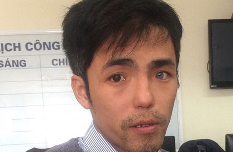 
Đôi mắt mỗi bên một màu được đối tượng Nguyên tận dụng đóng vai... Việt kiều
