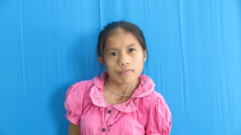 Phép màu xuất hiện sau 20 năm cuộc đời của cô gái trẻ Thái Nguyên - 1 Vi Thị Phú mắc dị tật xương hàm, khớp cổ lệch, vẹo cột sống và dị tật tai