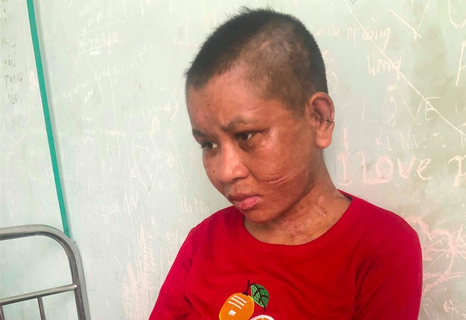 Bộ trưởng Lao động đề nghị xử nghiêm vụ bạo hành nữ lao động tại Gia Lai - 1
Cbị Y Nhiêu (Ảnh: Báo Giao thông)