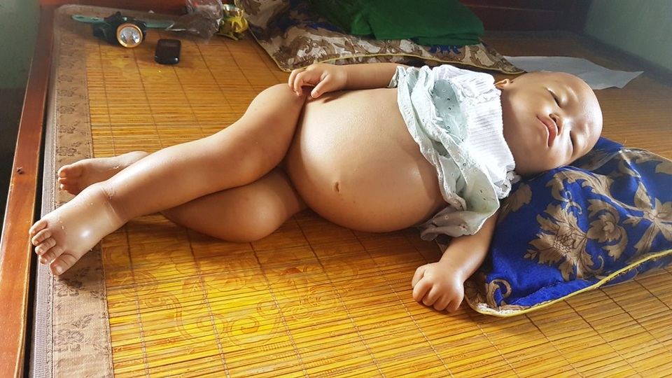 Thêm gần 30 triệu đồng đến với cháu bụng to như cái trống - 2 Cháu Huyền bụng ngày càng to thêm.