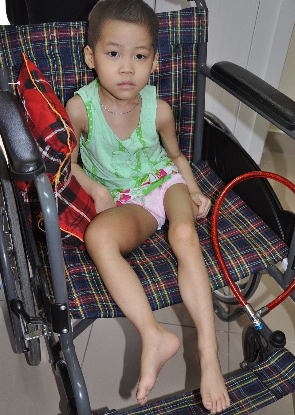 Bé Hoài Giang 5 tuổi phát hiện bị ung thư xương nên phải nhập viện điều trị.