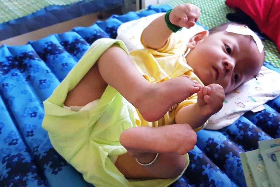 Gần 100 triệu đồng đến với 2 cháu bé mắc bệnh hiểm nghèo - 4 Từng ngày trôi qua, bé Gia Bảo càng khốn khổ, chịu biết bao đau đớn từ sự hành hạ của bệnh tật.