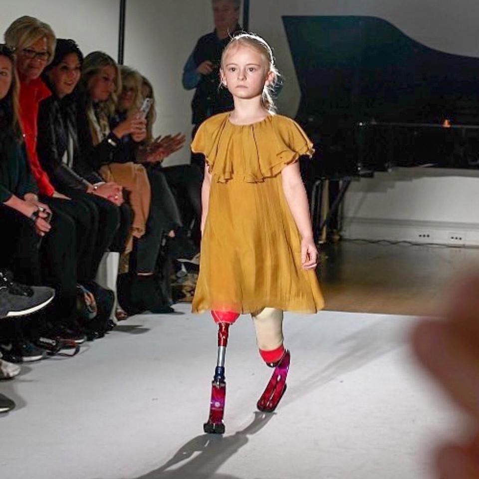 Người mẫu nhí khiếm khuyết cơ thể tự tin sải bước trên sàn catwalk - 2 Daisy không chỉ tự tin trong vai trò người mẫu, cô bé còn rất thích bộ môn thể dục nghệ thuật và luyện tập rất chăm chỉ.