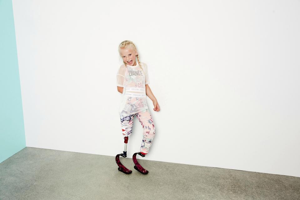 Người mẫu nhí khiếm khuyết cơ thể tự tin sải bước trên sàn catwalk - 4 Cô bé Daisy không để những khuyết thiếu của cơ thể cản bước tiến.