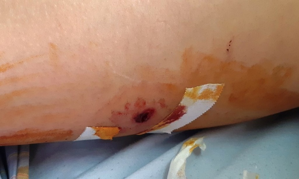 Hai “cẩu tặc” nghi dùng súng bắn người dân khi bị phát hiện - 3