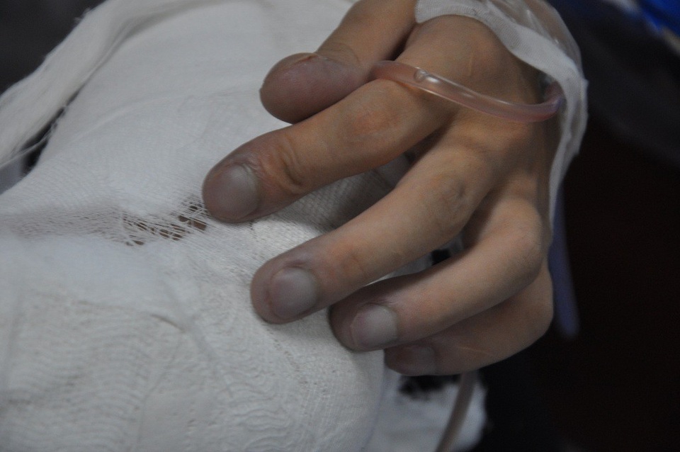 Các đầu ngón tay, ngón chân của cô bé Nhia hình dùi trống.