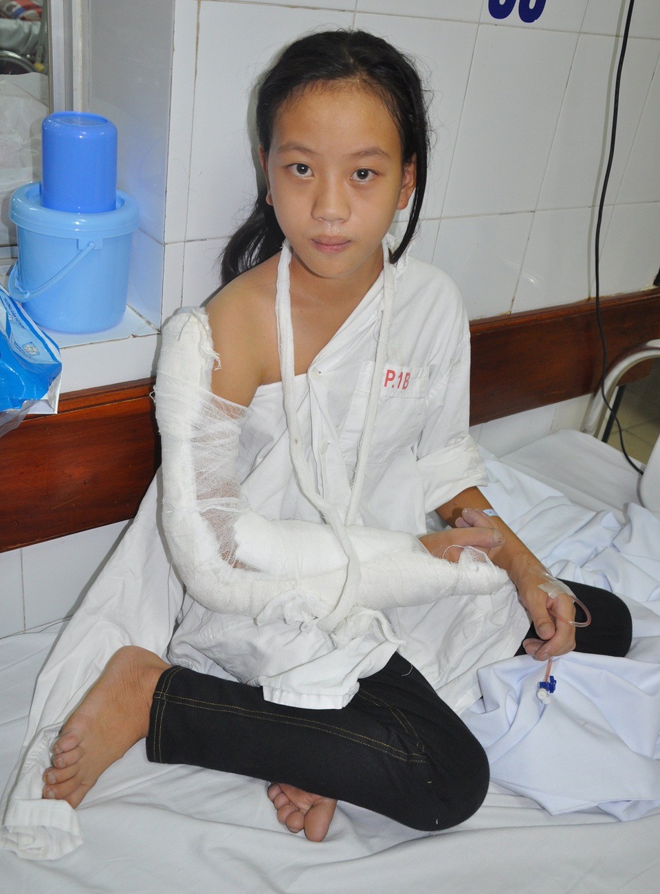 
Cô bé Nhia được đưa lên viện cấp cứu vì có 2 vết rò mủ ở tay.
