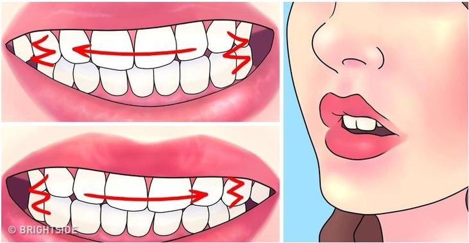 Làm thế nào để không nghiến răng khi ngủ? - Ảnh 1. Làm thế nào để không nghiến răng khi ngủ? - Ảnh 1.
