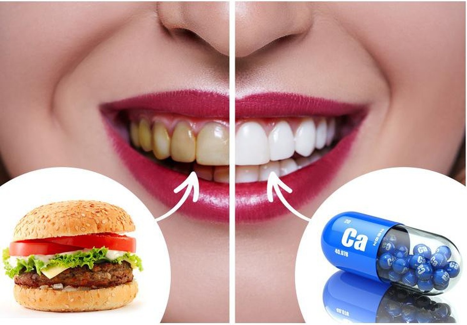 Làm thế nào để không nghiến răng khi ngủ? - Ảnh 5. Làm thế nào để không nghiến răng khi ngủ? - Ảnh 5.