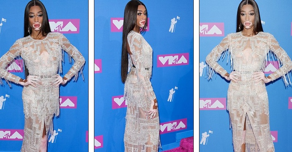 Hai siêu mẫu đọ dáng với trang phục xuyên thấu - 8
Không kém phần quyến rũ khi xuất hiện là siêu mẫu Winnie Harlow