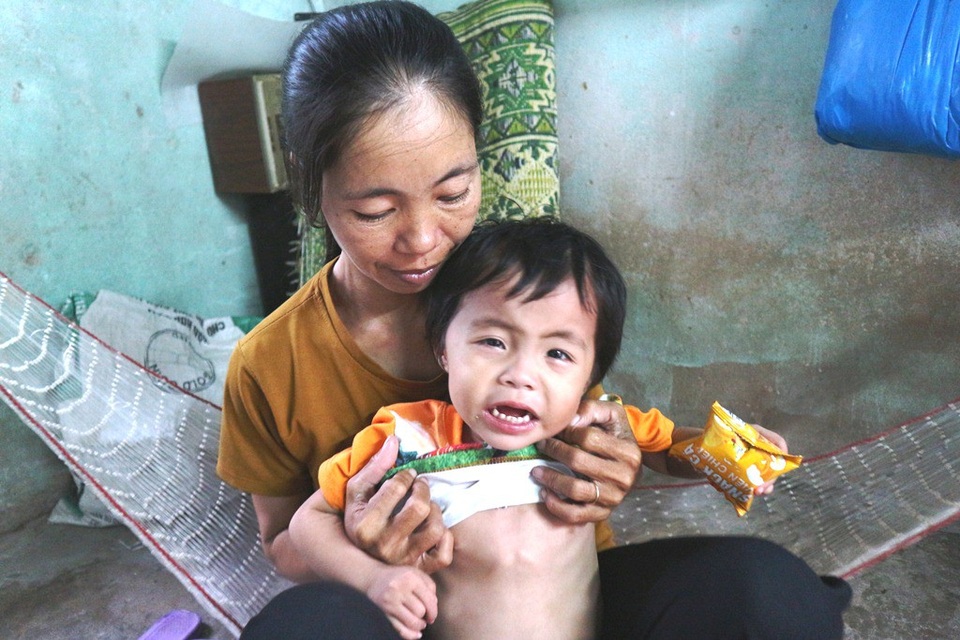 Nhói lòng bé 2 tuổi khóc trắng đêm vì mắc bệnh tim bẩm sinh - 1 Chị Vinh chia sẻ: Vì mắc bệnh tim nên sức khỏe cháu yếu lắm. Cháu thường xuyên khóc nên chỉ có cách nằm trên võng, dùng tay xoa nhẹ lưng thì cháu mới dễ chịu...