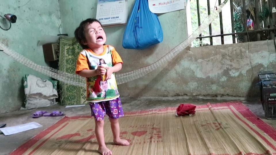 Nhói lòng bé 2 tuổi khóc trắng đêm vì mắc bệnh tim bẩm sinh - 3 Nhói lòng bé 2 tuổi khóc trắng đêm vì mắc bệnh tim bẩm sinh - 3