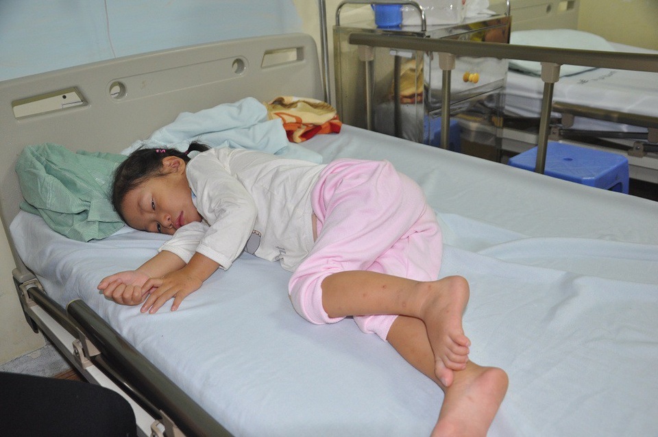 Thiếu 100 triệu đồng phẫu thuật, bé 3 tuổi có nguy cơ chết vì bố mẹ không có tiền - 2 Ở bệnh viện, em gần như mê mệt nên nằm yên, không nói chuyện.