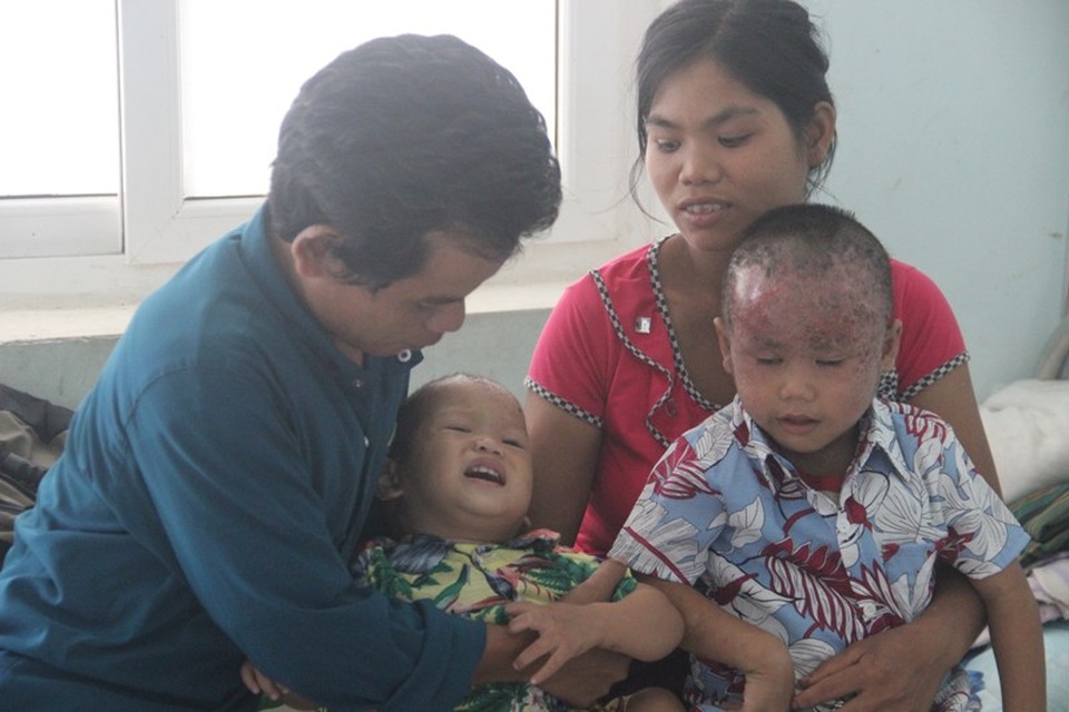 Nhói lòng nhìn 2 cháu nhỏ vùng cao bị lở loét hết da đầu - 1 Hai đứa con trai của vợ chồng anh Vốc mang cái đầu lở loét