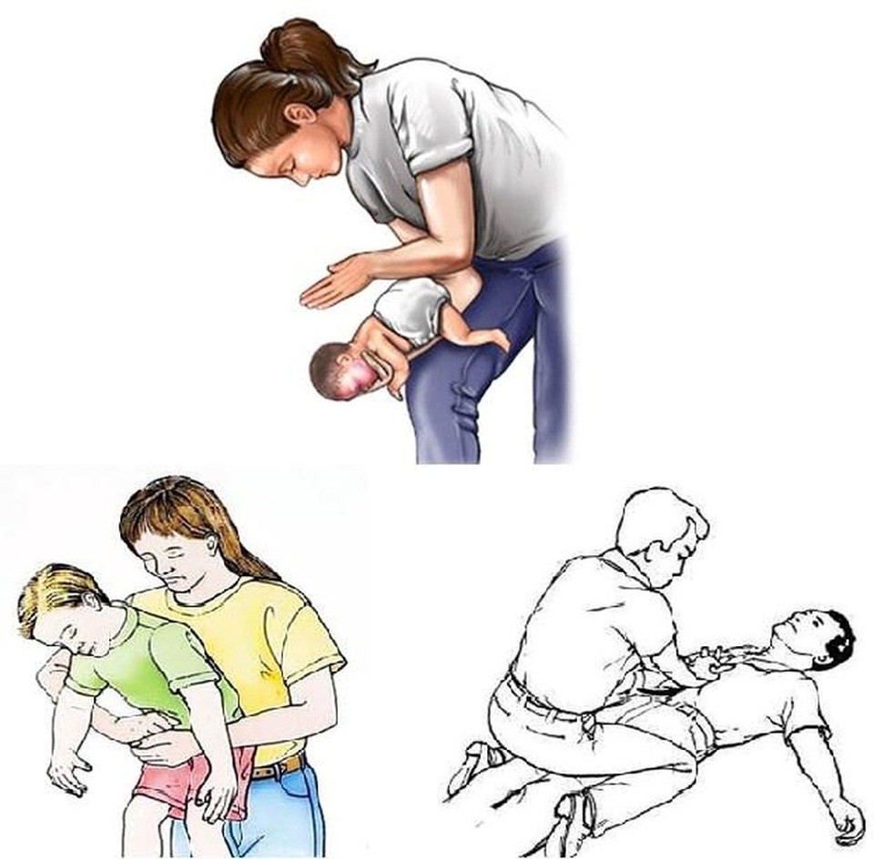 Hút trà sữa quá mạnh, bé gái 11 tuổi tử vong - 2 Hút trà sữa quá mạnh, bé gái 11 tuổi tử vong - 2