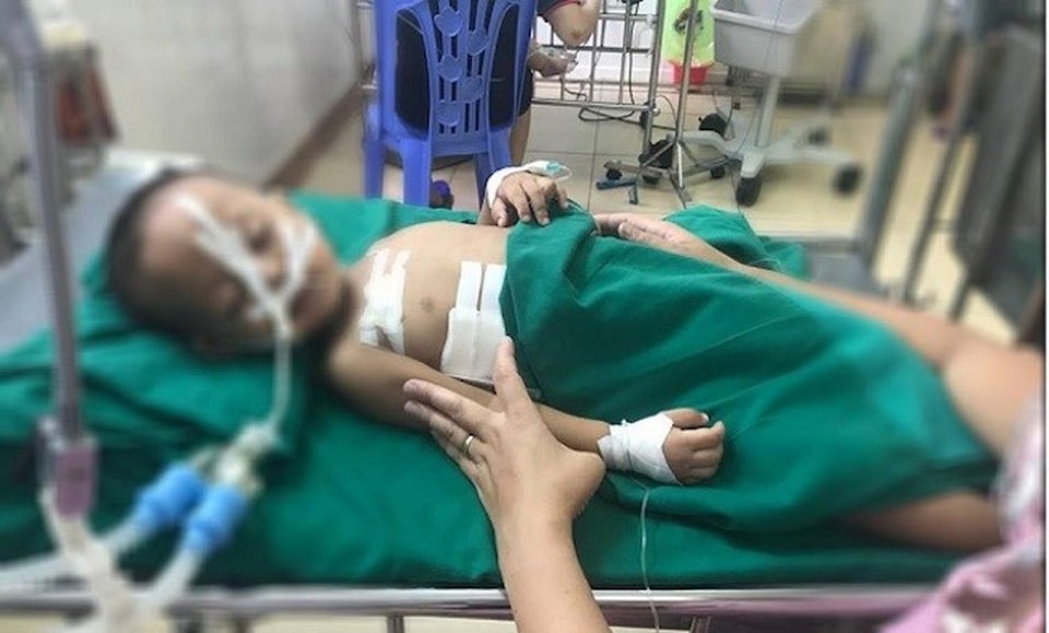 Chơi đùa với súng hơi, bé 19 tháng tuổi bị thương ở ngực - 1 Cháu T. được cấp cứu tại bệnh viện.